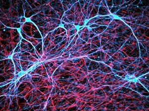 Fluorescence Micrograph Gallery: Nerve and glial cells, light micrograph