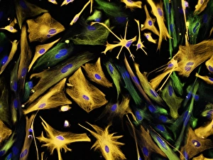 Fluorescence Micrograph Gallery: Neural progenitor cell differentiation C018 / 8758