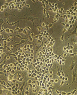 Stem Cell Gallery: Neural stem cells