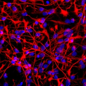 Confocal Gallery: Neural stem cells in culture