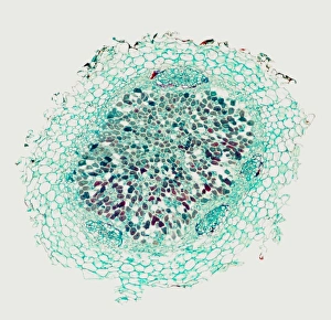 Nitrogen-fixing root nodule, micrograph Nitrogen-fixing root nodule, micrograph