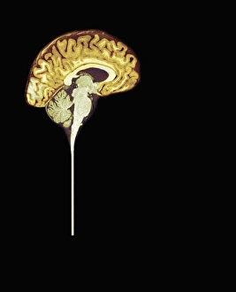 Central Nervous System Gallery: Normal human brain, MRI scan C016 / 8843