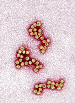 Norovirus particles, TEM