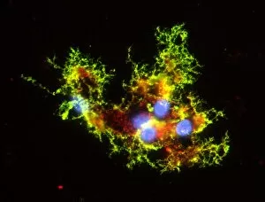 Light Micrograph Gallery: Oligodendrocyte nerve cells