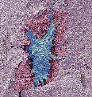 Osteocyte bone cell, SEM C016 / 9025