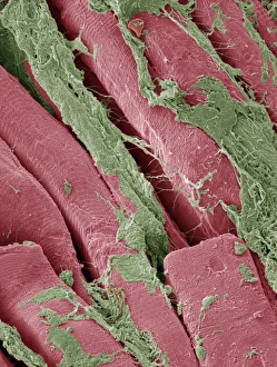Periodontal ligament fibres, SEM Periodontal ligament fibres, SEM