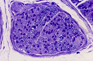 Nuclei Gallery: Peripheral nerve, light micrograph
