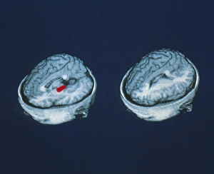 PET brain scans showing mistaken memory of words PET brain scans showing mistaken memory of words