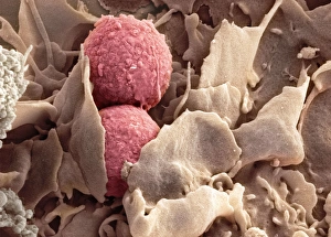 Immunology Gallery: Phagocytosis of fungus spores, SEM