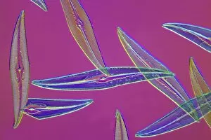 Pleurosigma sp diatoms, light micrograph