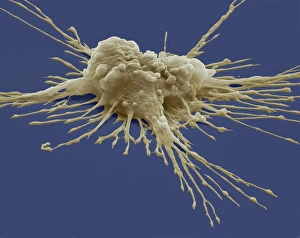 Stem Cell Gallery: Pluripotent stem cell, SEM