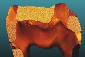 Polarised LM of a tooth with various fillings