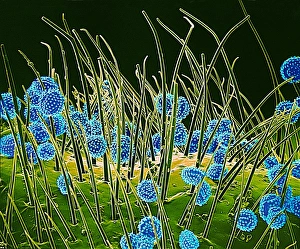 Pollen grains on a harelquin bug, SEM Pollen grains on a harelquin bug, SEM