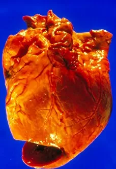 Images Dated 11th February 2003: Post-mortem specimen of human heart