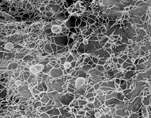 Protoplast showing cellulose microfibrils Protoplast showing cellulose microfibrils