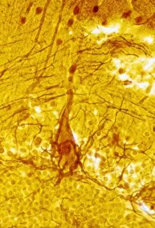 Cell Body Gallery: Purkinje nerve cell C013 / 9763