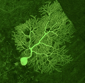 Cell Body Gallery: Purkinje nerve cell, light micrograph