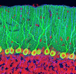 Nervous System Gallery: Purkinje nerve cells in the cerebellum