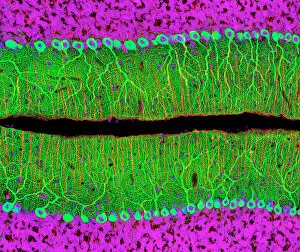 Purkinje nerve cells in the cerebellum