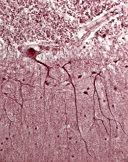 Cell Body Gallery: Purkinje neurons, light micrograph