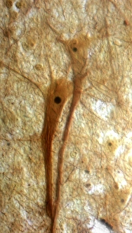 Cell Body Gallery: Pyramidal neurons, light micrograph