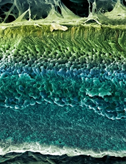 Retina, SEM