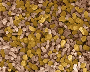 Rod and cone cells of the eye, SEM C014/4864 Rod and cone cells of the eye, SEM C014/4864
