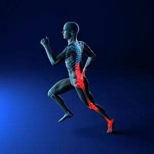 Concepts Collection: Running injuries, conceptual artwork