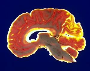 Sagittal slice through a healthy human brain