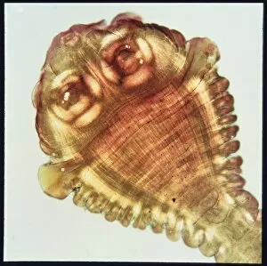 Scolex (head) of a beef tapeworm, Taenia saginata