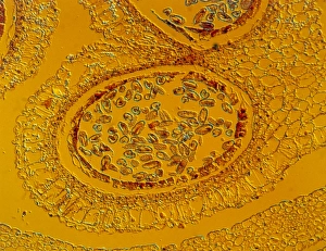 Section through a lily anther with pollen Section through a lily anther with pollen