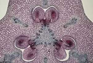 Section through a lily ovary with ovules Section through a lily ovary with ovules