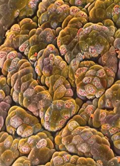 SEM of acini cells in pancreas
