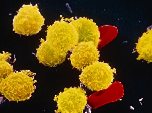 SEM of human lymphocytes & erythrocytes SEM of human lymphocytes & erythrocytes