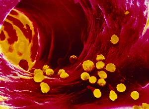 SEM of interior of artery in human liver SEM of interior of artery in human liver