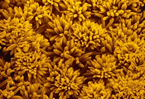 Images Dated 5th March 1988: SEM of kettle fur