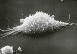 Images Dated 21st July 2003: SEM of a macrophage cell moving over a surface