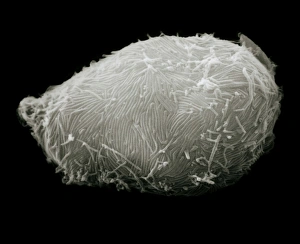 SEM of mutant blood cell surface infected with HIV SEM of mutant blood cell surface infected with HIV