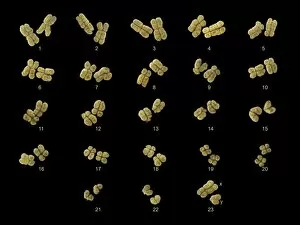 DNA Collection: Full set of male chromosomes, SEM