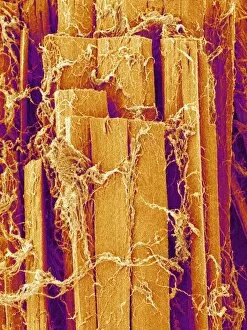 Images Dated 17th September 2004: Skeletal muscle fibre