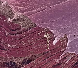 Images Dated 19th February 2002: Skeletal muscle, SEM