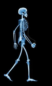 Digital Collection: Skeleton drinking, X-ray