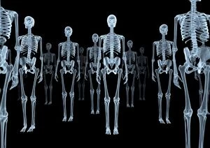 Bones Gallery: Skeletons, X-ray artwork