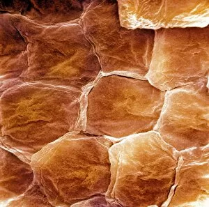 Images Dated 30th March 2009: Skin surface, SEM