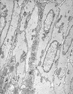 Nuclei Gallery: Smooth muscle tissue, TEM
