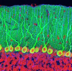 Human Body Prints: Fluorescent light micrograph print of Purkinje cells in the cerebellum