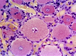 Spinal nerve ganglion, light micrograph Spinal nerve ganglion, light micrograph