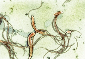 Spirochete bacteria, TEM
