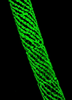 Confocal Gallery: Spirogyra algae