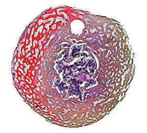 Light Microscope Gallery: Spongy bone, light micrograph